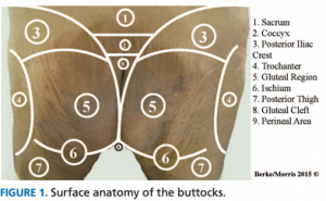 How to prevent pressure ulcers on the buttocks? - O Neill Healthcare